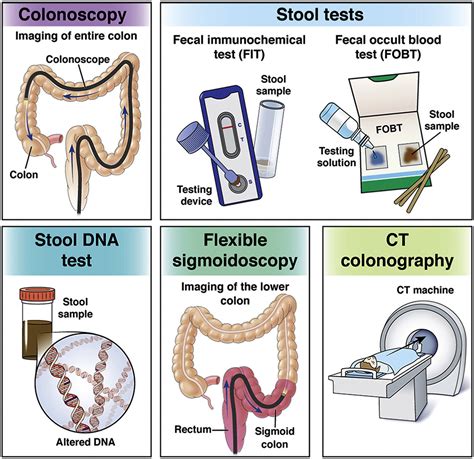 lab tests for colon cancer